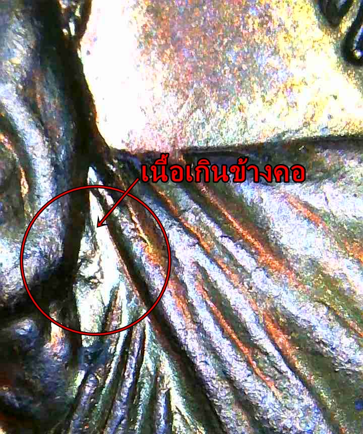 เนื้อเกินระฆังหน้ากองพัน